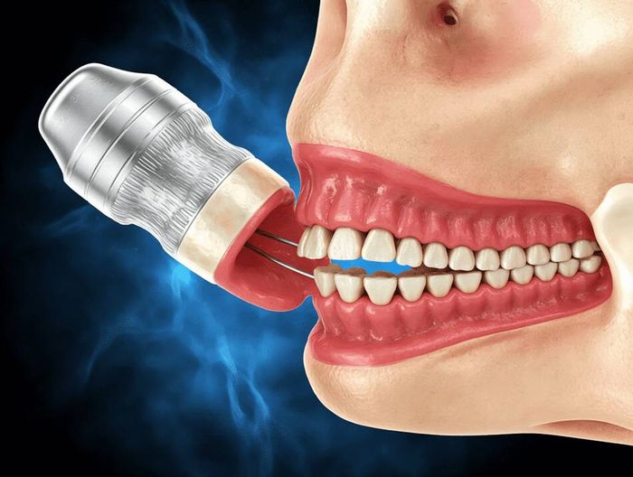 椎间融合器生物相容性检测