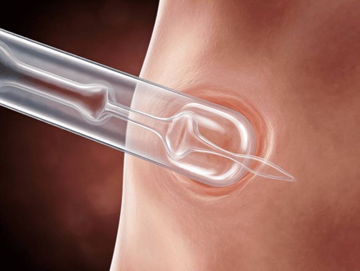 中心静脉导管生物相容性检测