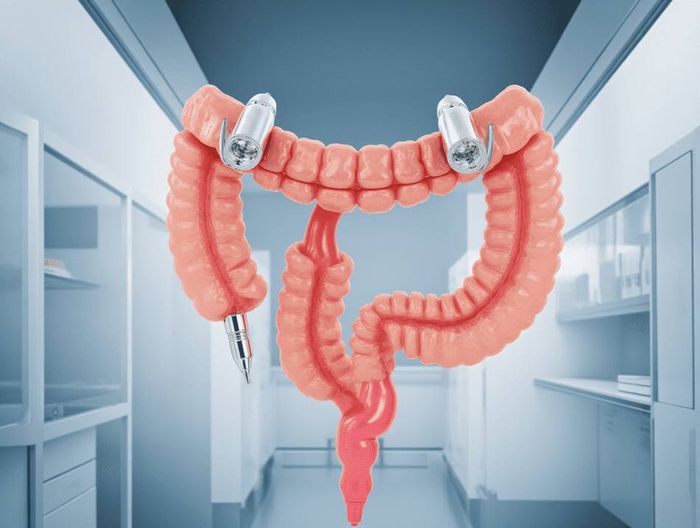 尿道支架临床前性能验证