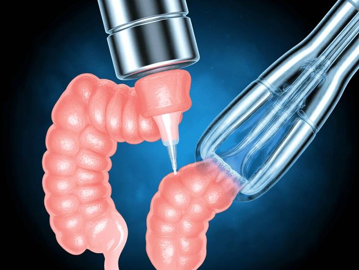 肠镜咬口生物相容性检测