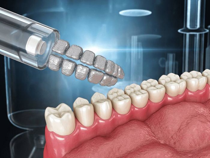口腔正畸托槽化学表征检测
