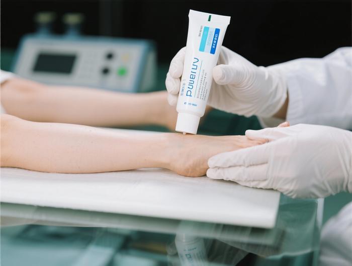 足癣乳膏透皮吸收测试