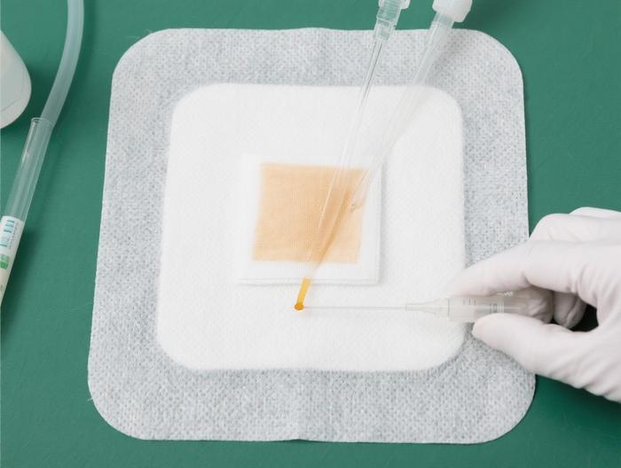 藻酸盐敷料透皮吸收测试