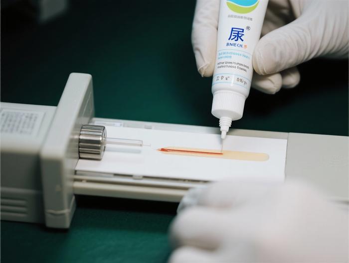 尿素软膏透皮吸收测试