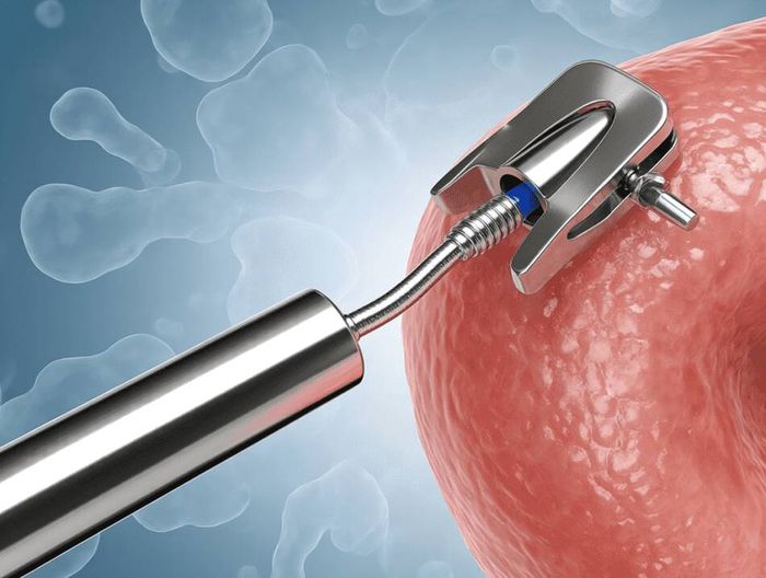 血管夹生物相容性检测