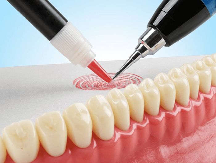 口腔印模材料化学表征检测