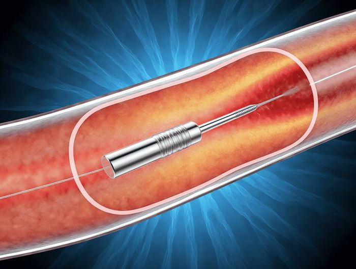 输尿管导丝生物相容性检测