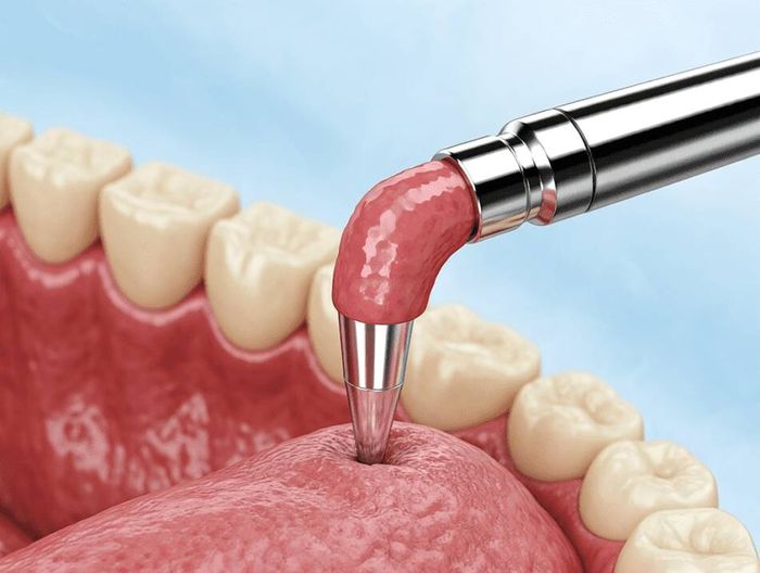 钴铬合金植入物生物相容性检测