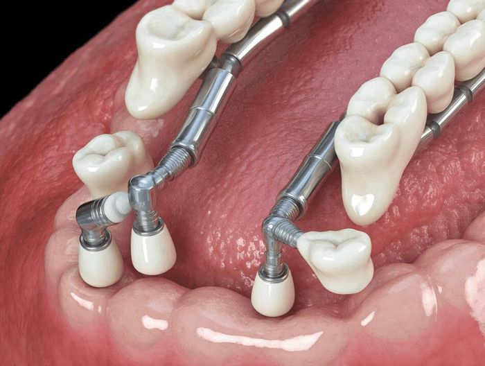 软组织固定装置生物相容性检测