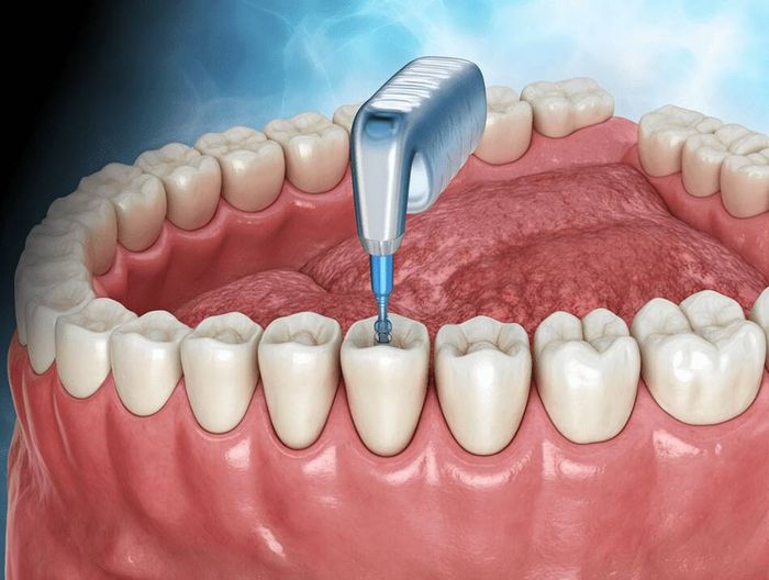 义齿基托材料生物相容性检测