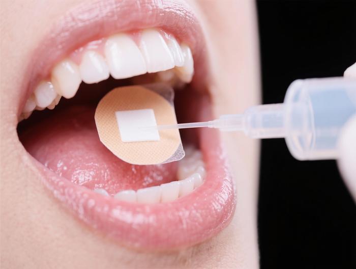 口腔黏膜贴片透皮吸收测试